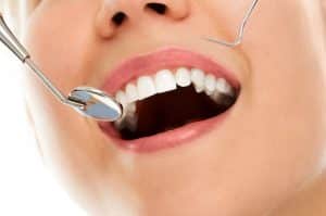تاريخ بداية طب الاسنان العام