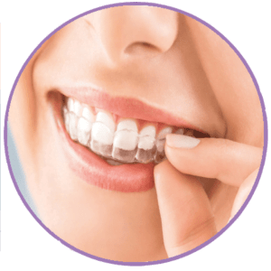 تقويم الاسنان الشفاف اللامرئي  