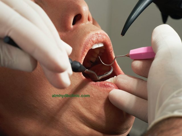 طبيب يفحص اسنان المريض