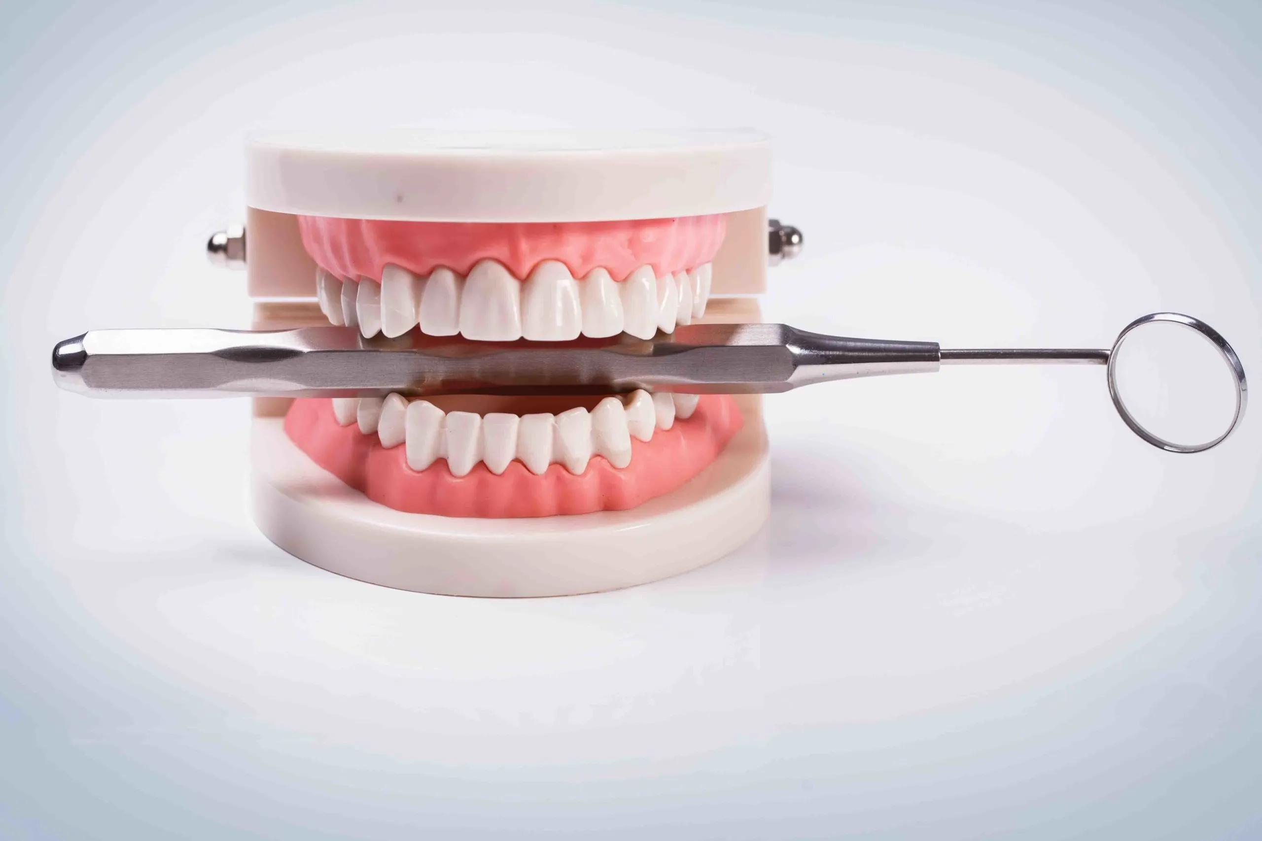 أنواع أطقم الأسنان المتحركة واسعارها