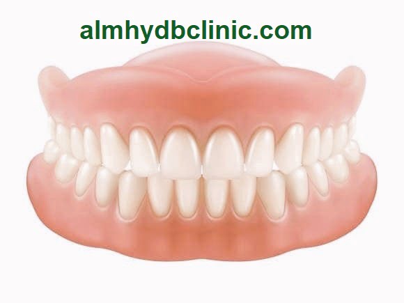 تركيب الاسنان المتحركه معلومات هامة | وهل يوجد طقم اسنان في الصيدليات