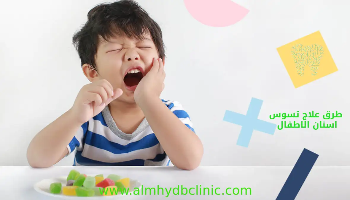تسوس اسنان الأطفال تعرف علي الاسباب والاعراض وطرق العلاج