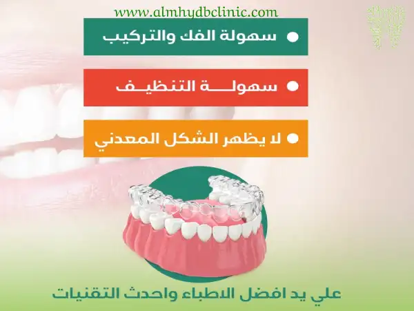 التقويم الشفاف انفزلاين كل ما تحتاج معرفته عن تقويم الاسنان الشفاف