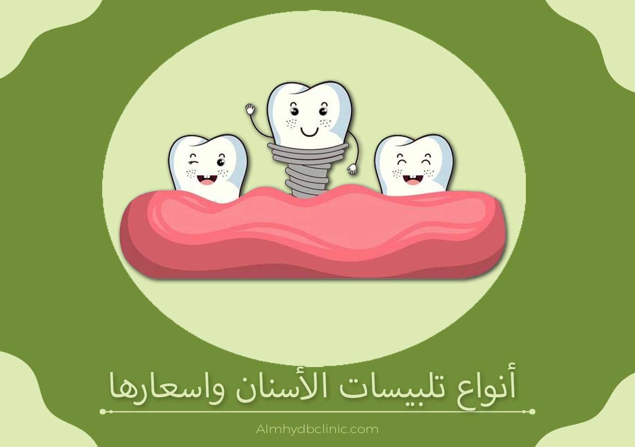 أنواع تلبيسات الأسنان واسعارها