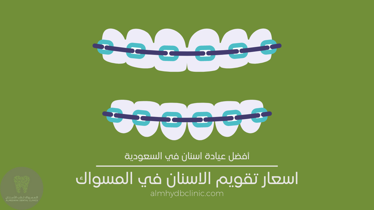 اسعار تقويم الاسنان في المسواك لطب الاسنان