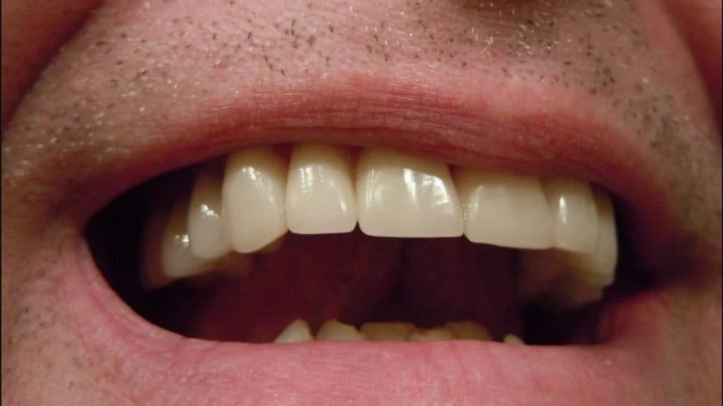 افضل مضاد حيوى لخراج الاسنان (1)