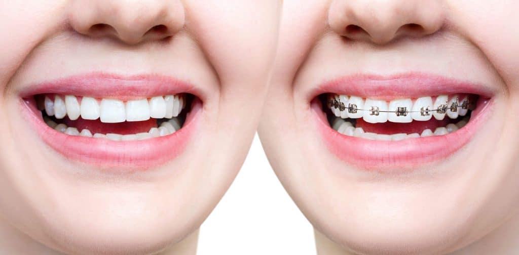 الأضرار الصحية لطب الأسنان التجميلي