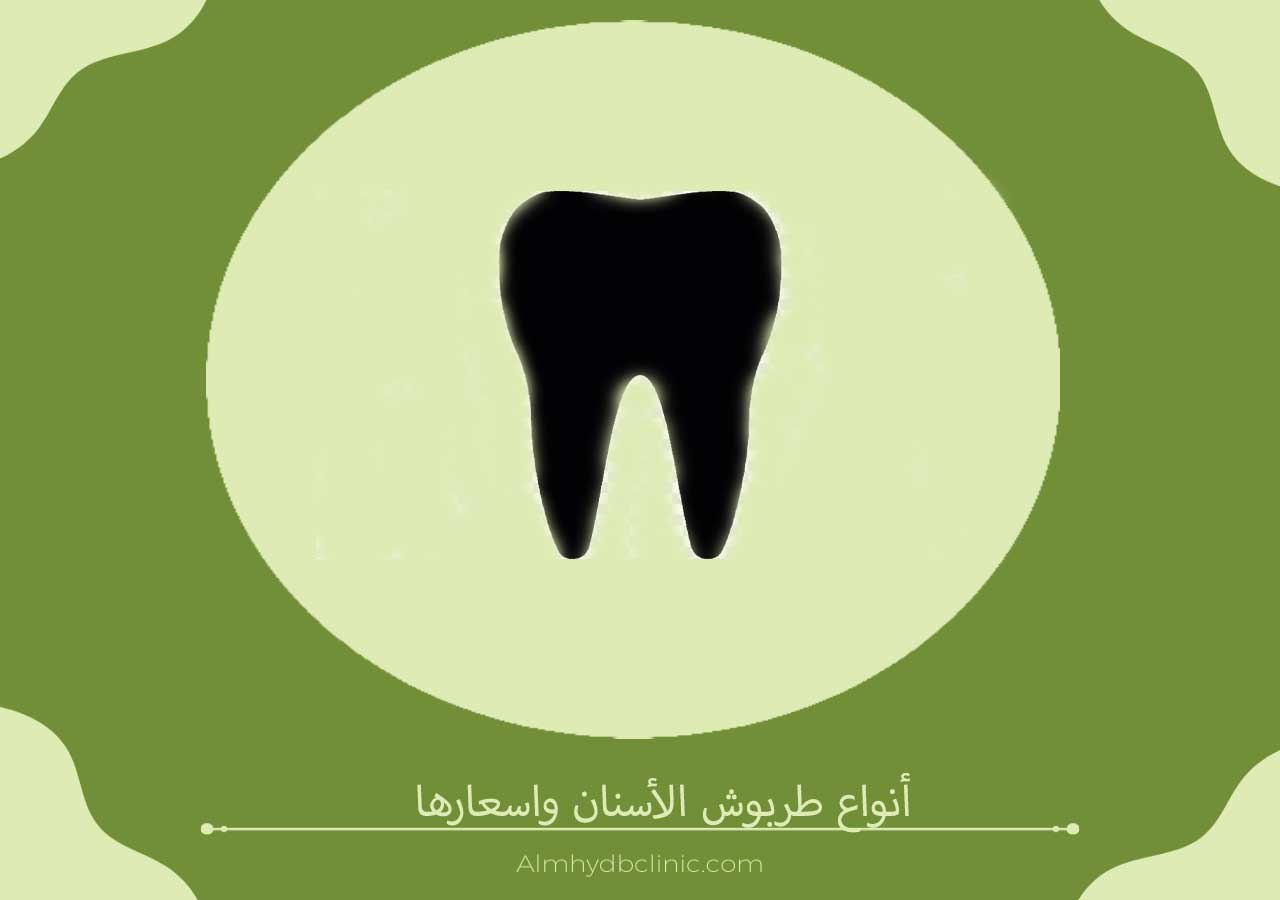 أنواع طربوش الأسنان واسعارها 