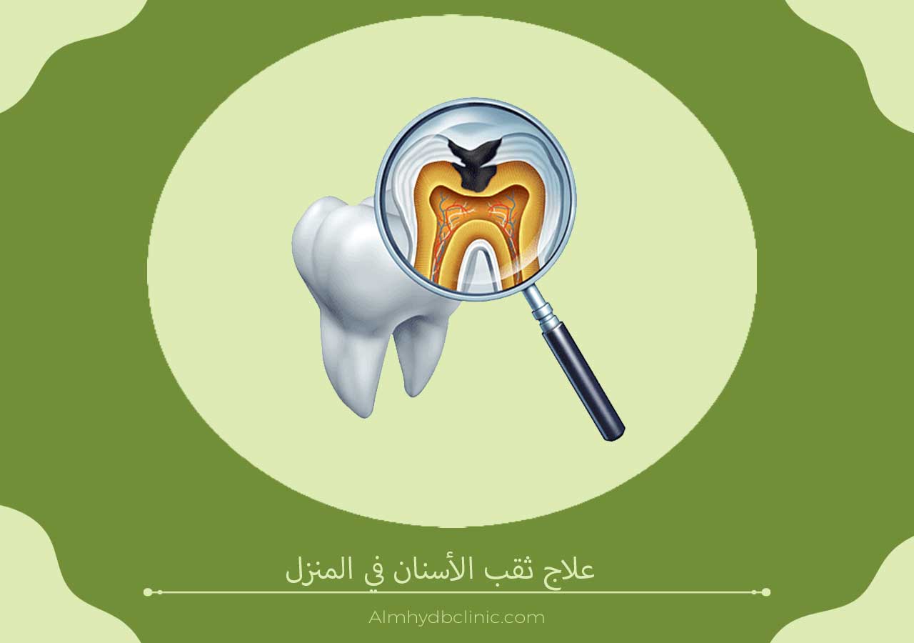 علاج ثقب الأسنان في المنزل