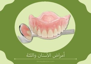 أمراض الأسنان واللثة