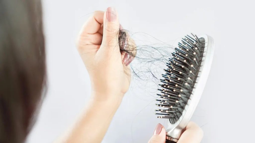 عيوب الريجينيرا بديل زراعة الشعر